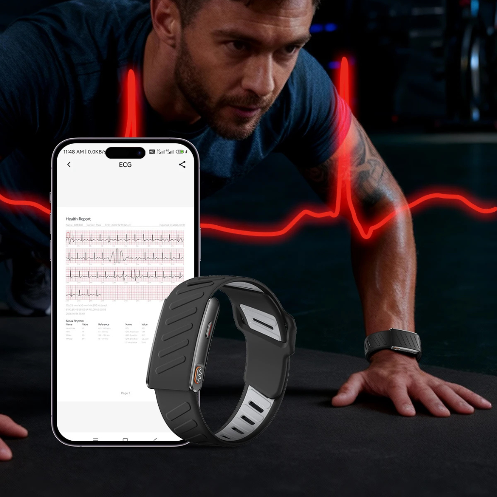 Smart Tracker KR96 PRO